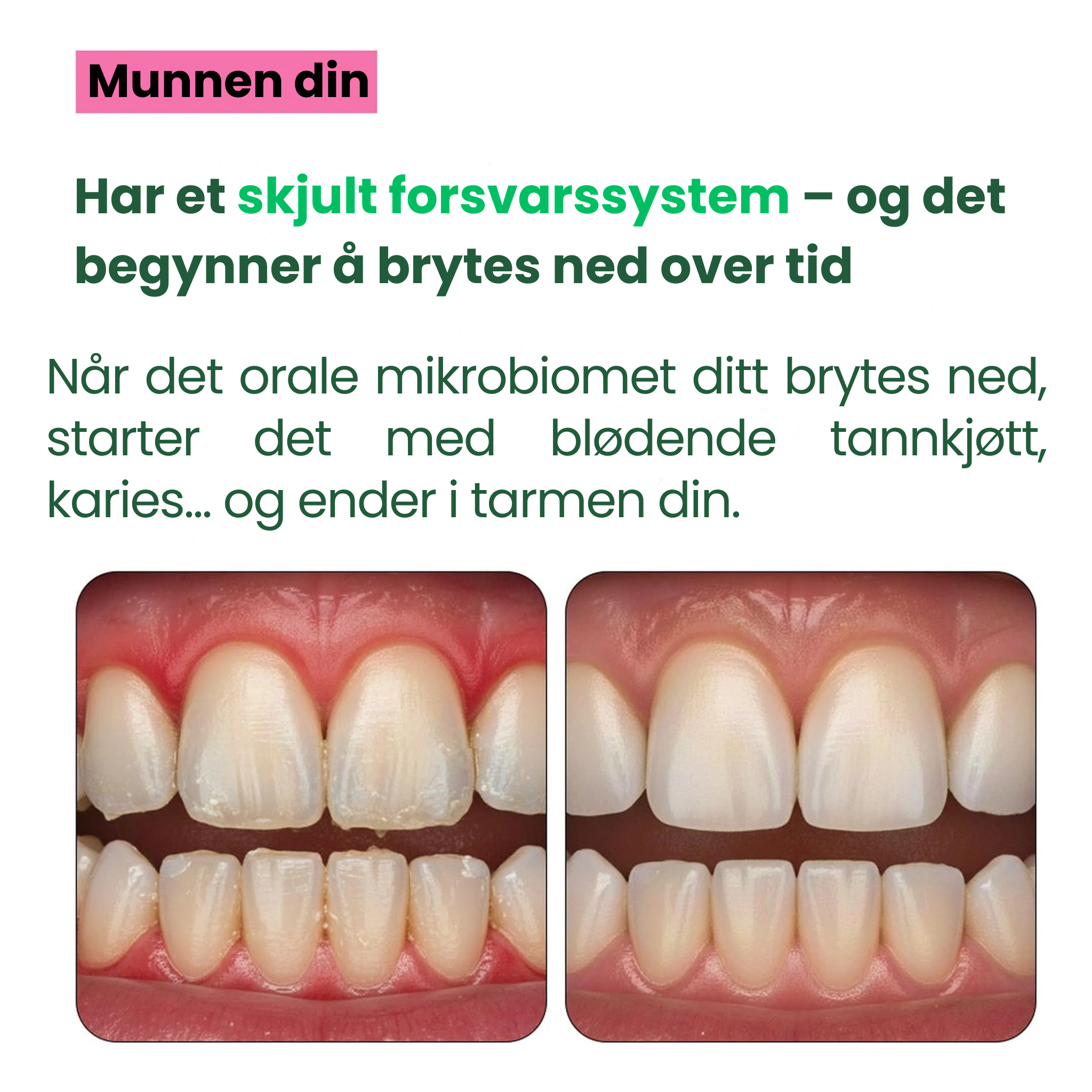 Oral Defence – Maksimal styrke for gjenoppretting av munnens mikrobiom