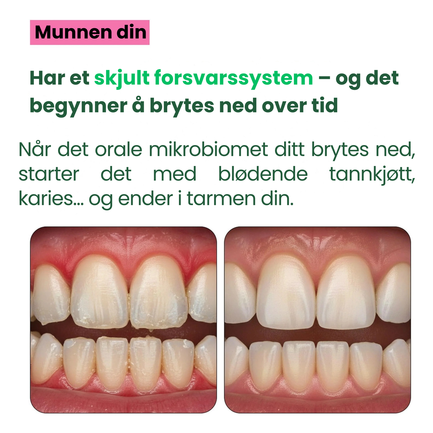 Oral Defence – Maksimal styrke for gjenoppretting av munnens mikrobiom